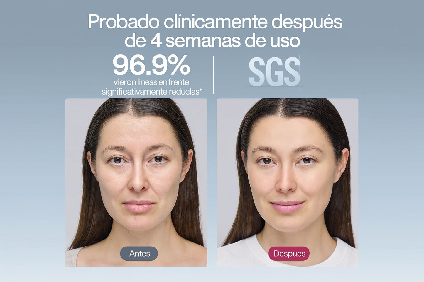 Ulike ReGlow – 4 Modos de terapia en 1: Una solución completa para el cuidado de la piel